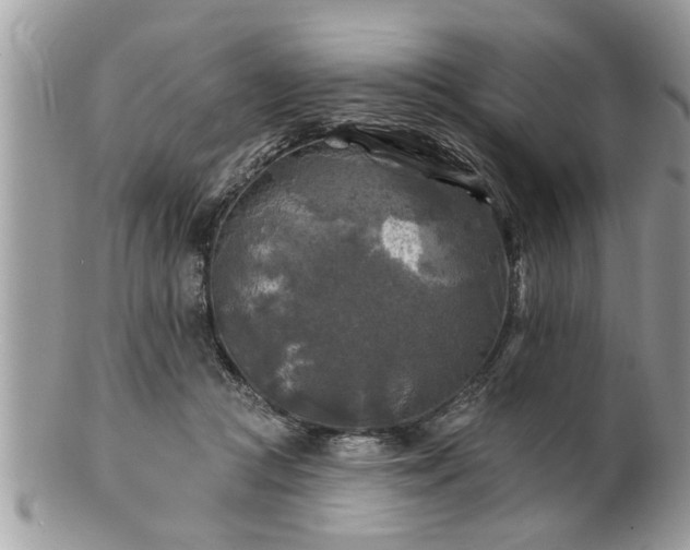 X0000100970361200807011426