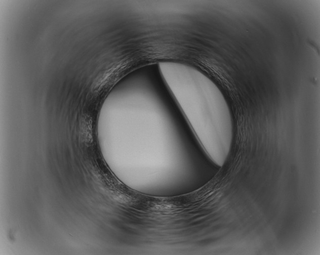 X0000100980547200806241151