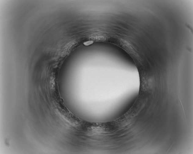 X0000100980259200807011450