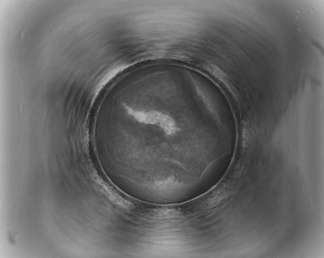 X0000100981024200807011438