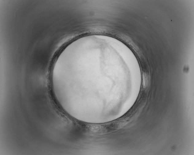 X0000100980579200807151417