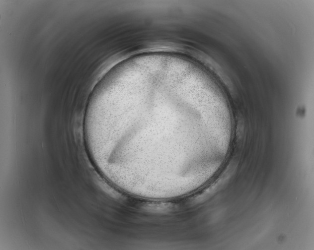 X0000100981417200807151404