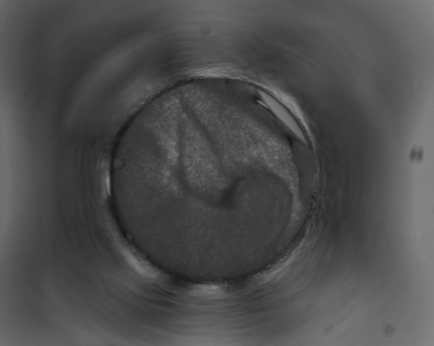 X0000101090061200807171858