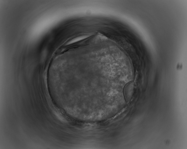 X0000101090099200807171857