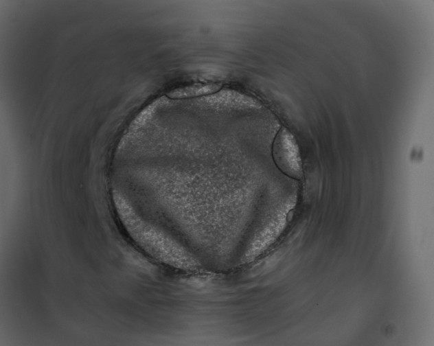 X0000101091345200807171838