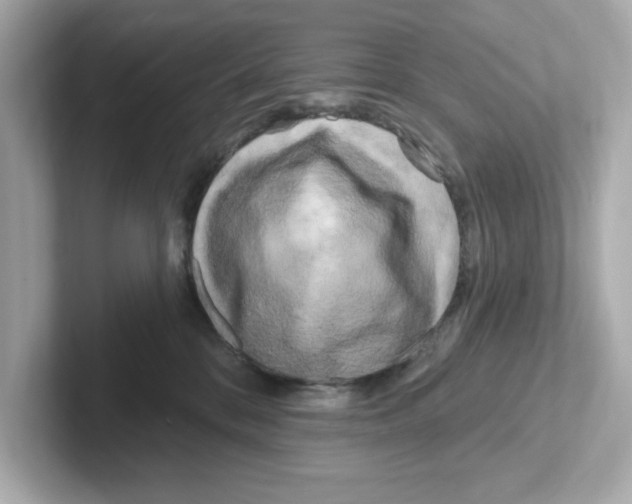 X0000101090328200807241013