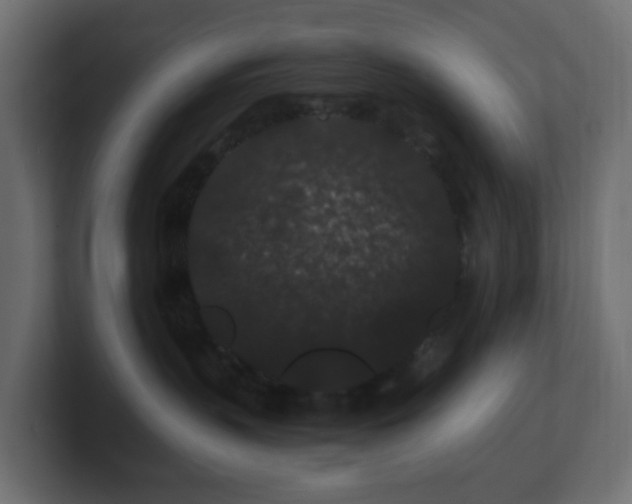 X0000101100383200806261517