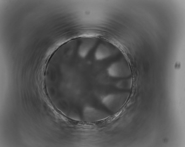 X0000101100337200807031755