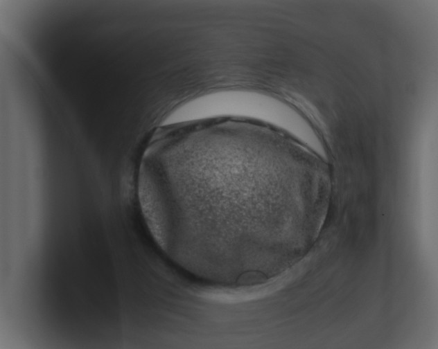 X0000101100017200807101457