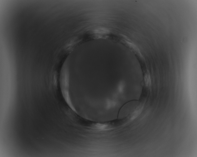 X0000101100570200807101450