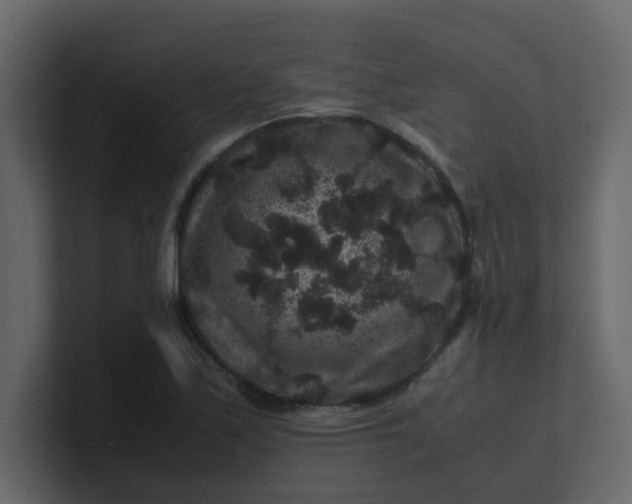 X0000101101171200807101441