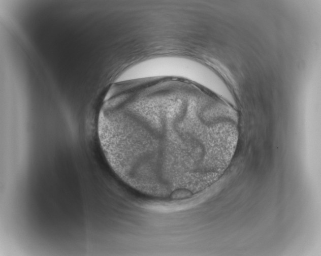 X0000101100017200807241037