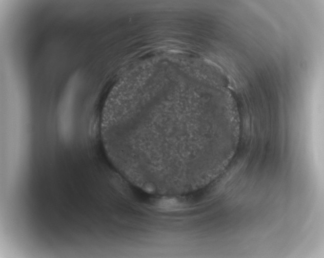 X0000101100177200807241035