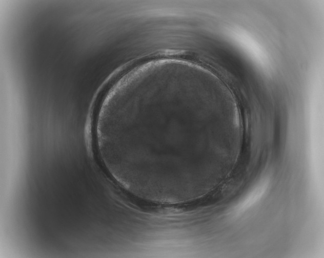 X0000101100387200807241032