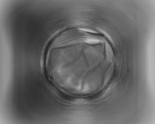 X0000101100399200807241032