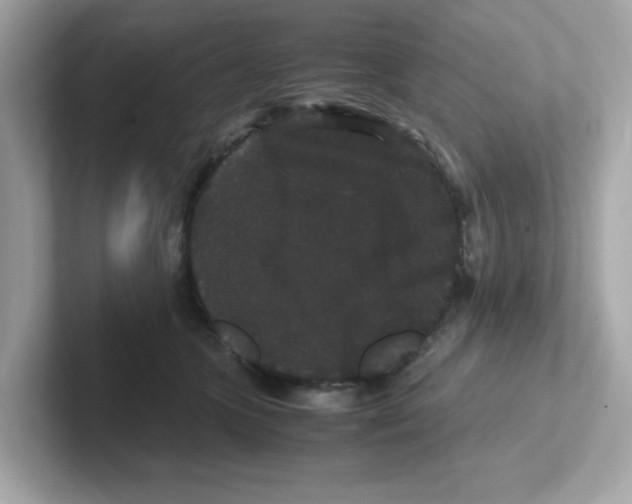 X0000101100563200807241030