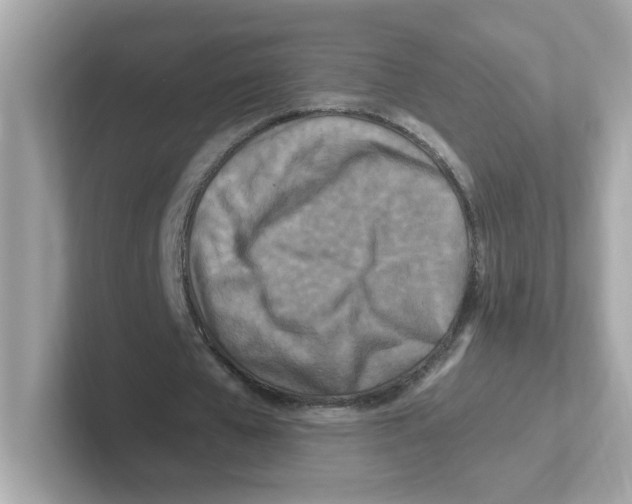 X0000101100577200807241030