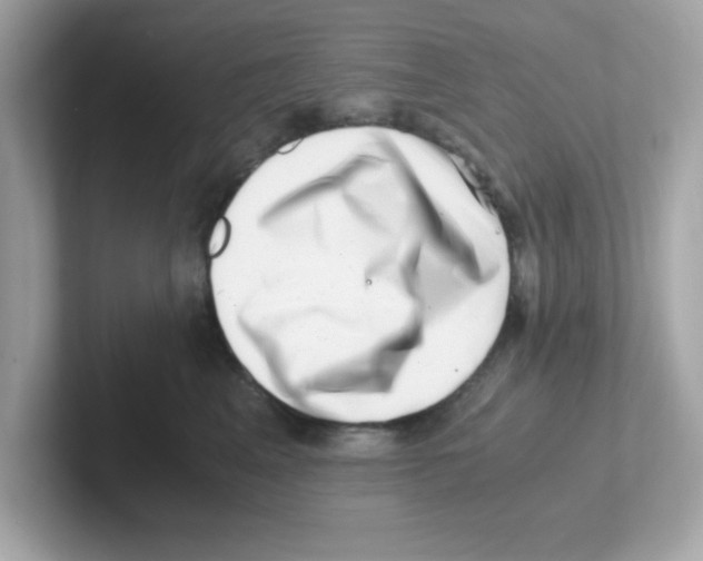 X0000101100617200807241029