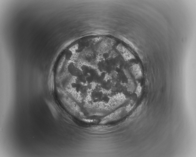 X0000101101171200807241022
