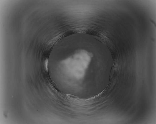 X0000101110047200807031750