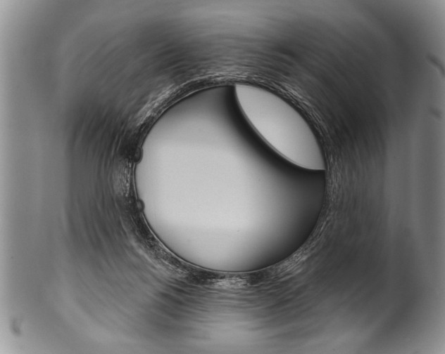 X0000101120168200806261054