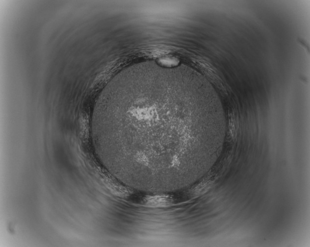 X0000101120461200806261440