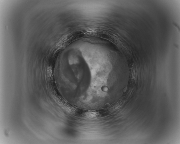 X0000101120711200806261436