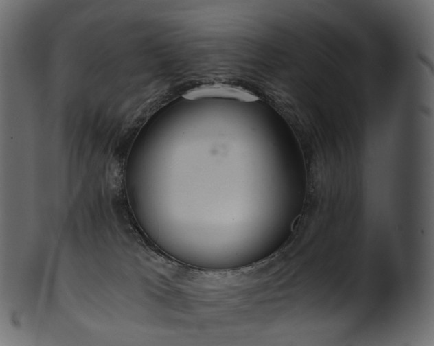 X0000101120037200807031814