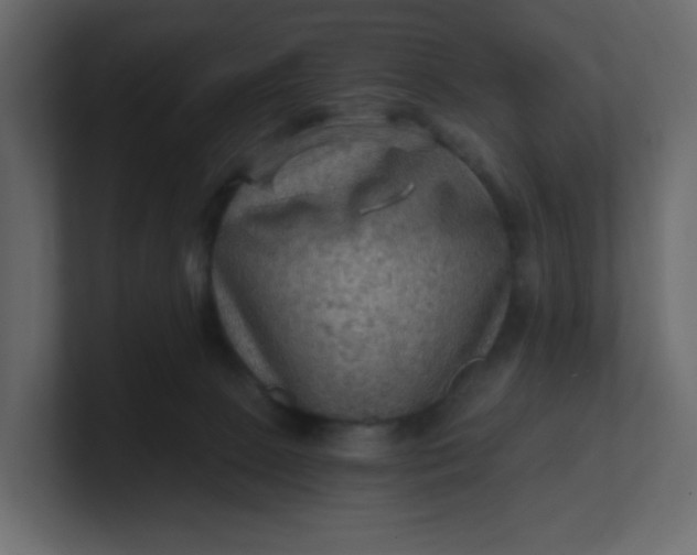 X0000101120081200807101552
