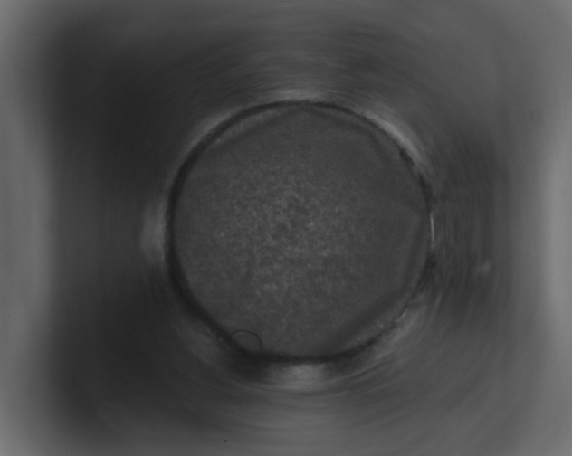 X0000101120156200807101550