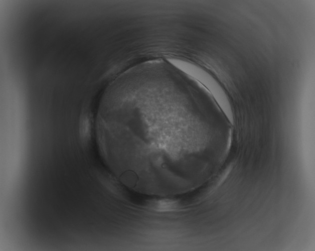 X0000101120165200807101551