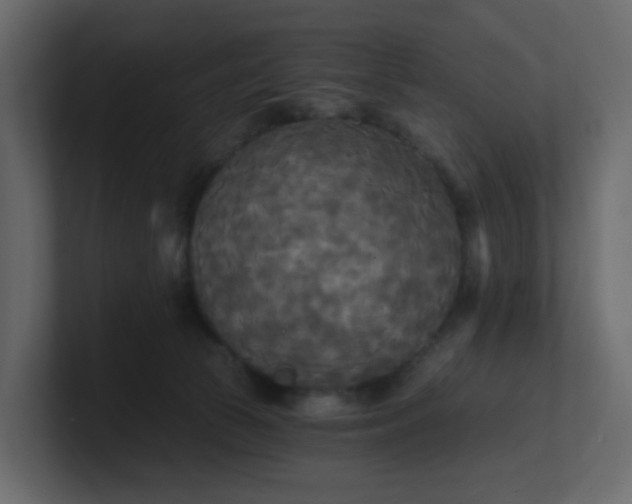 X0000101120177200807101551