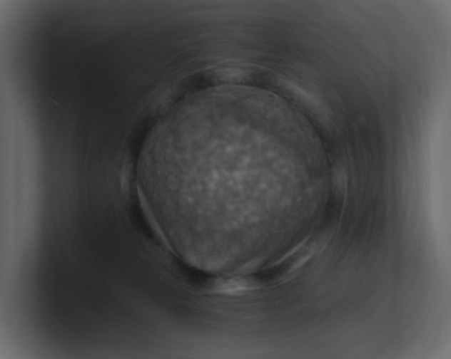 X0000101120181200807101551