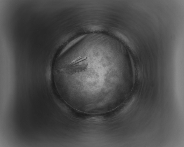 X0000101120447200807101546