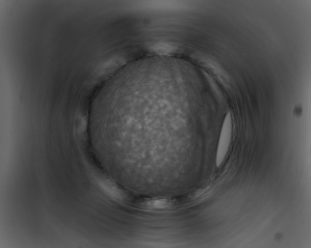 X0000101120365200807172006