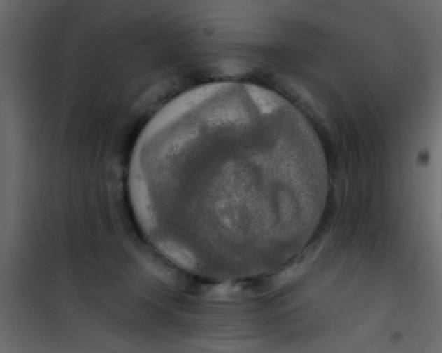 X0000101120366200807172006