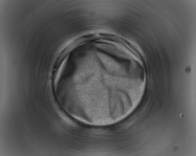X0000101120389200807172005