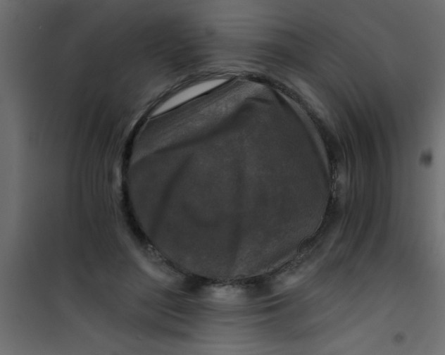 X0000101120500200807172003