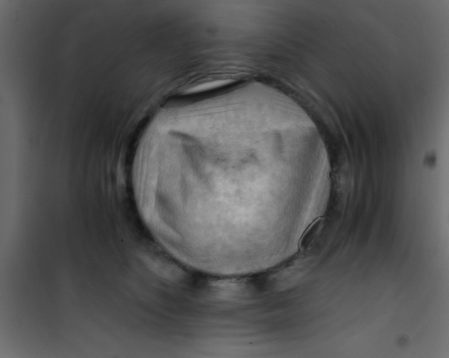 X0000101120516200807172003