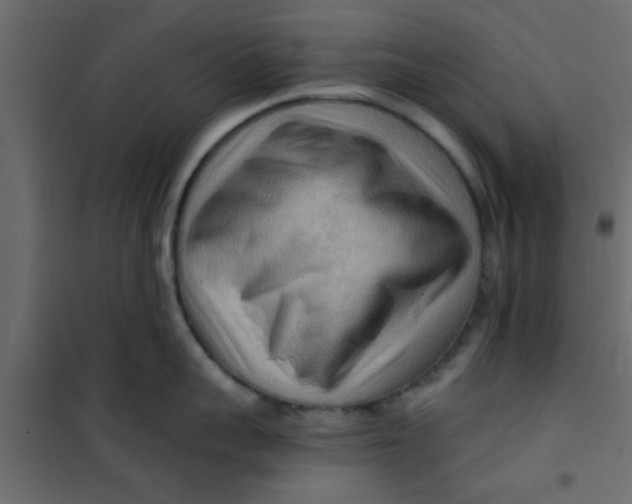 X0000101120959200807171957