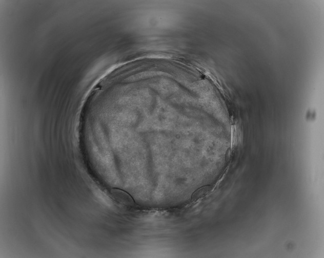 X0000101120243200807241206