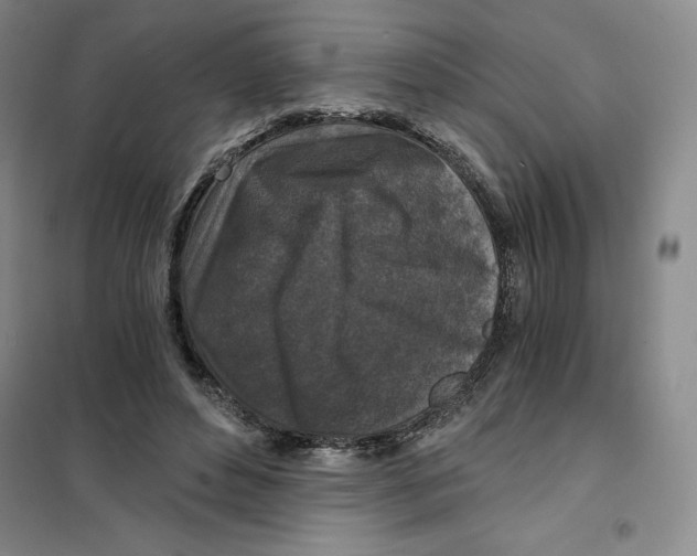 X0000101120496200807241203