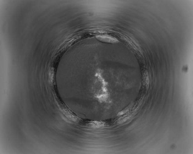 X0000101140328200806270925