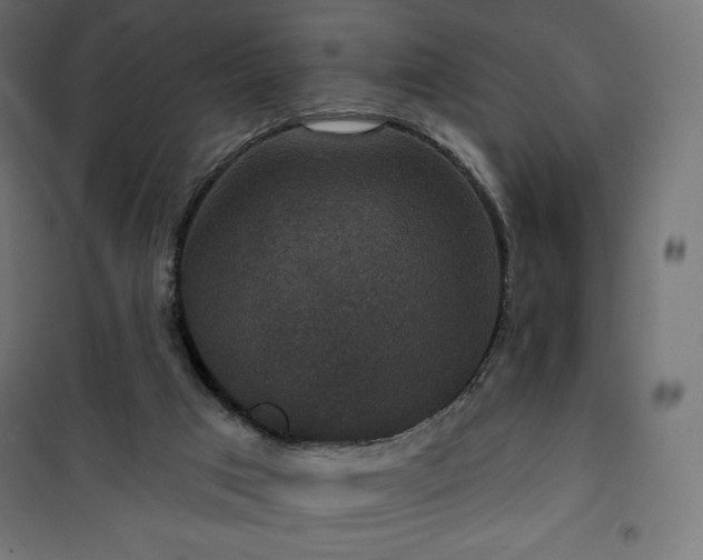 X0000101140017200807071136