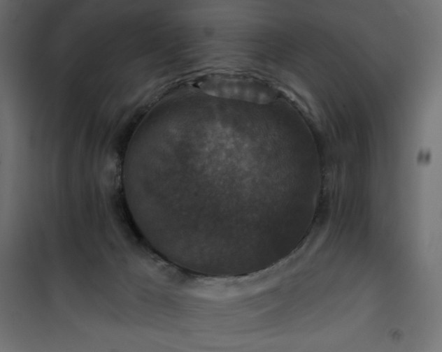 X0000101140029200807071136