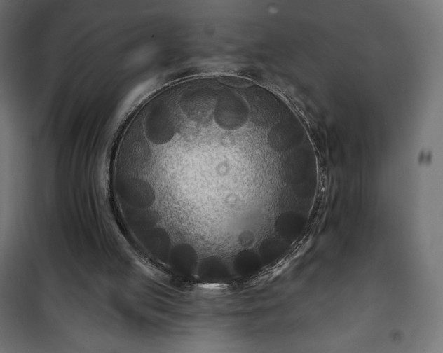 X0000101140053200807071135