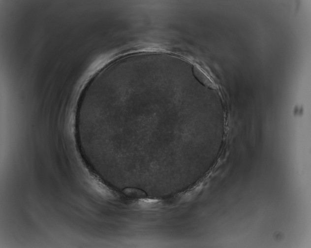 X0000101140055200807071135