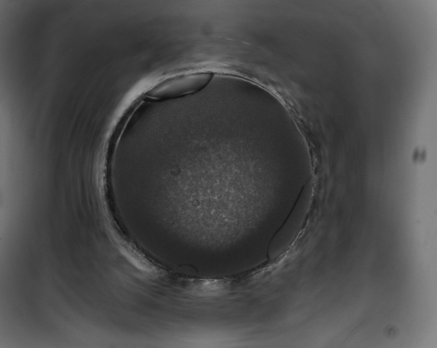 X0000101140056200807071135