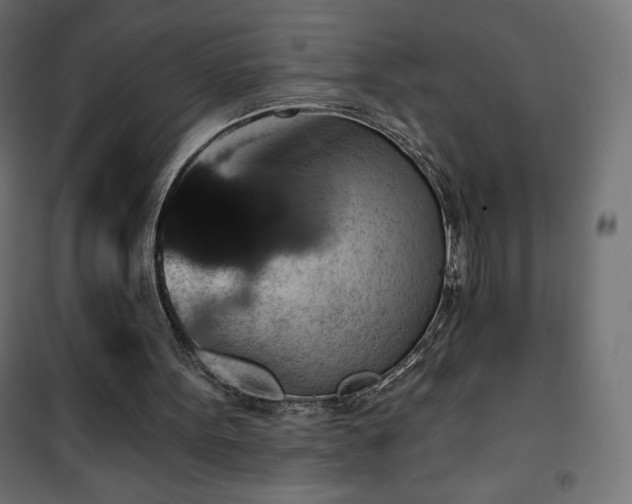 X0000101140099200807071135