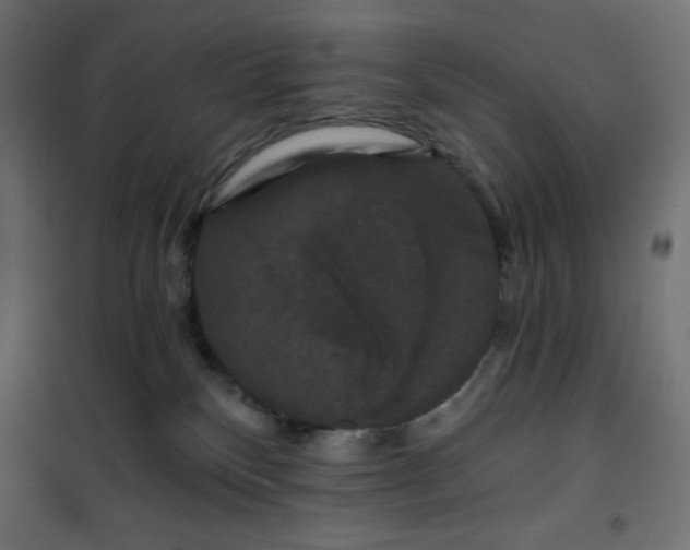 X0000101140136200807071134